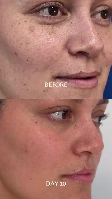 @Cohen MD Plastic Surgery