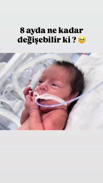 @Premat&uuml;re Annesi 🧚&zwj;♀️