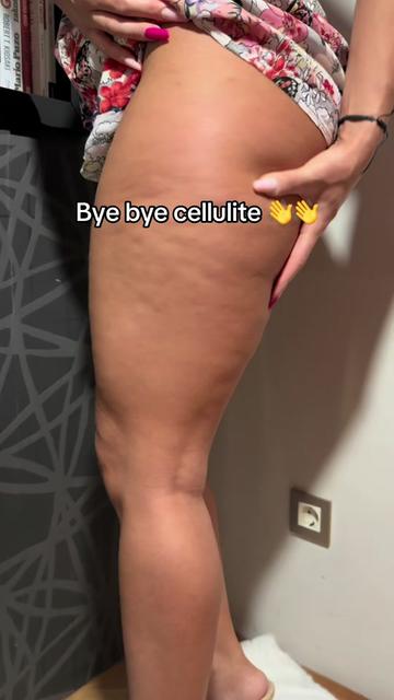@CelluSnap