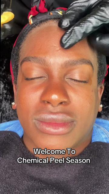 @Ronnie