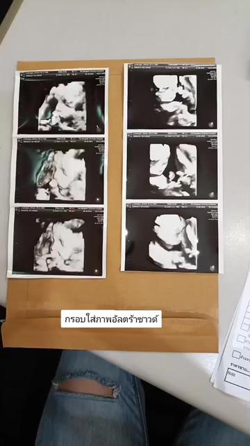 @BangkokFrame