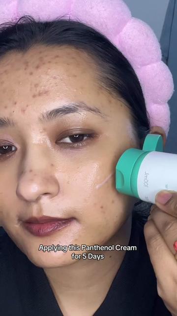 @Anuradha