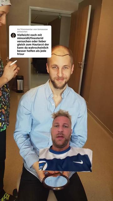 @Mr. Hairtransplant