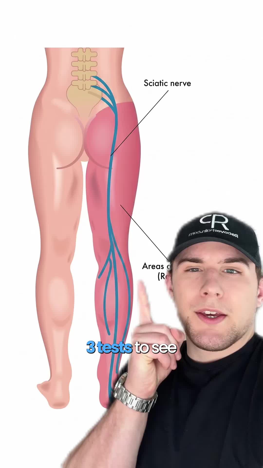 @Recover Pain