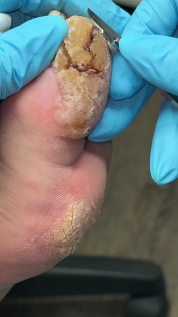 @Deniel Foot and Ankle Center