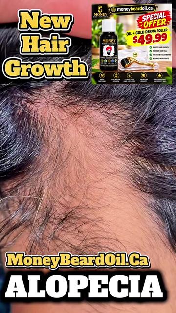 @money_beard_growthoil