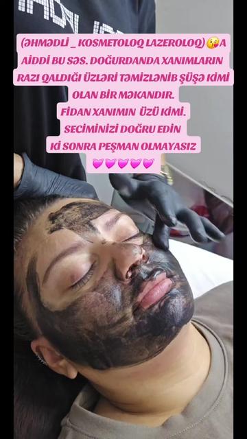 @ehmedli_kosmetoloq_lazeroloq