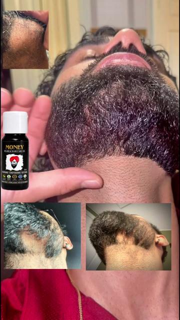 @money_beard_growthoil