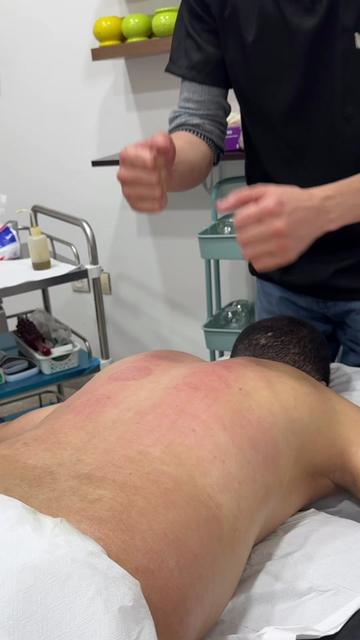 @Hijama.abdelmajid