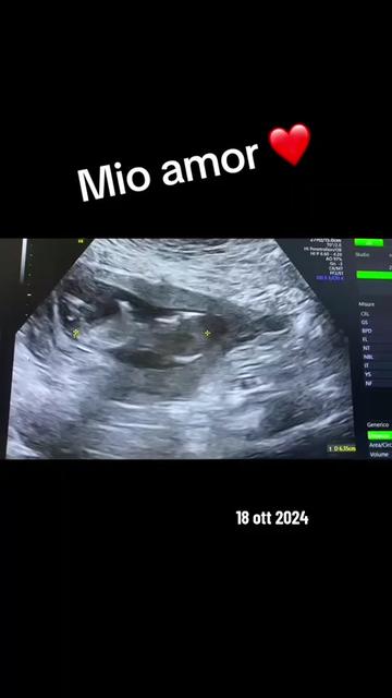 @Susy ❤️