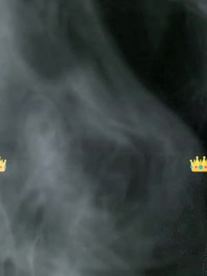 @user96793602752