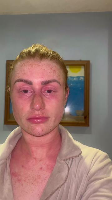 @my journey to repair my skin