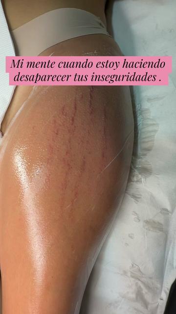 @Tania Estr&iacute;as