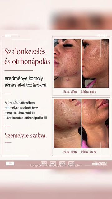 @Páll Patrícia Bőrterapeuta