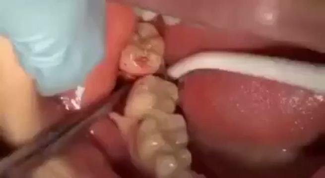 @Dent_tooth