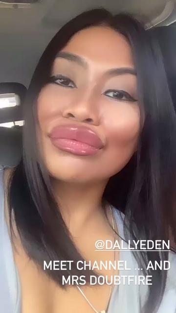 @Dally 3