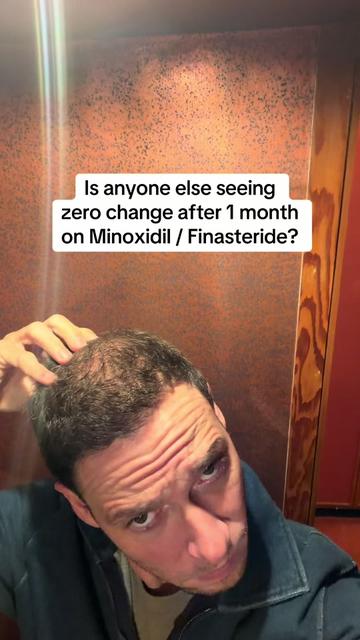 @scalp.hero