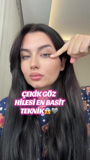 @Anita🫶🏼