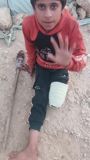 @Ali the amputee🇵🇸😭🥹