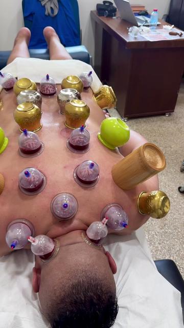 @Hijama.abdelmajid