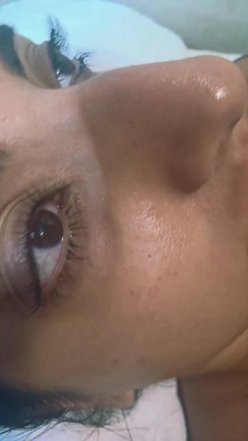 @EL Beauty & Aesthetic