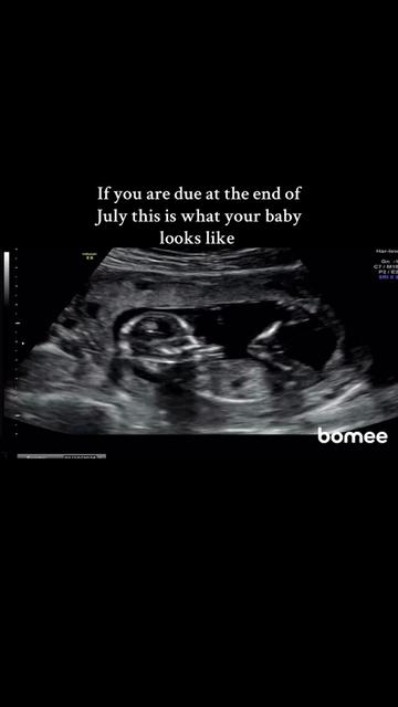 @j | ivf mama ❤️