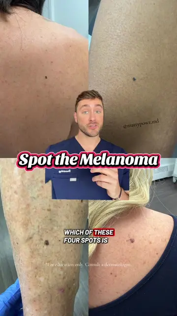 @Dr Mat | Dermatologist