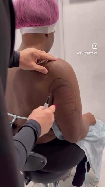 @BioAesthetic305