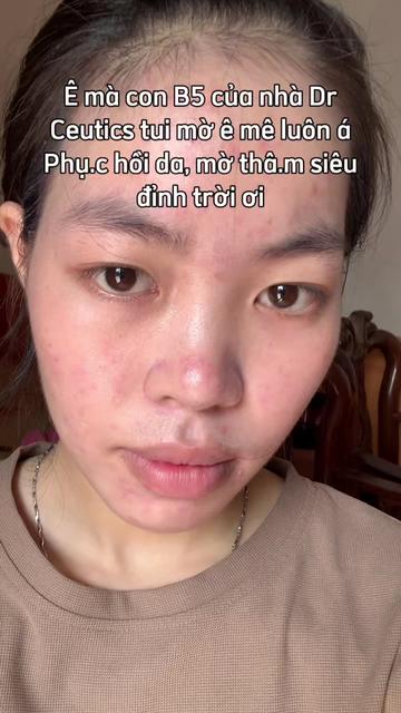 @Nguyen Thi Nhai
