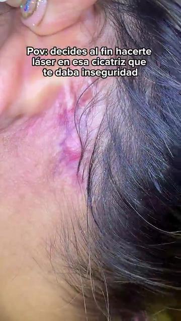 @Dr. Wilfrido Solano Derma