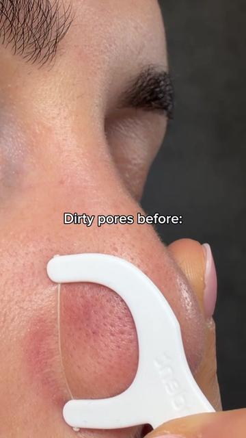 @Loresa