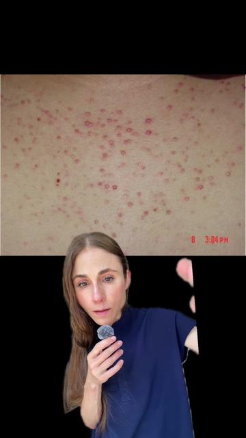 @Dr Dray | Dermatologist