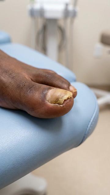 @Deniel Foot and Ankle Center