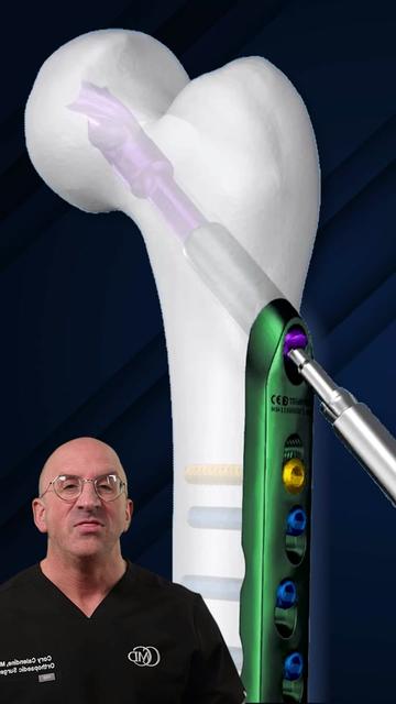 @Bone Doctor - Joint Pain MD