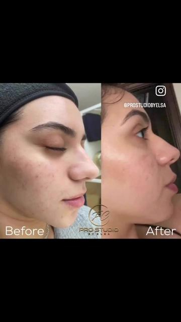 @Elsa Cardenas SCV Esthetician