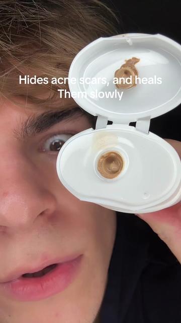 @Finn