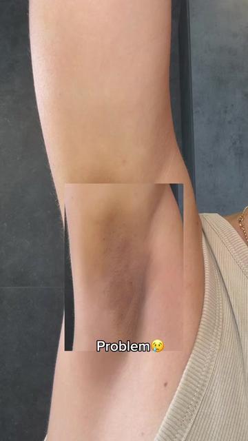 @Loresa