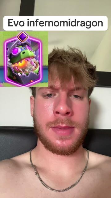 @fettion