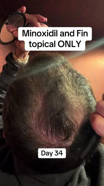 @scalp.hero