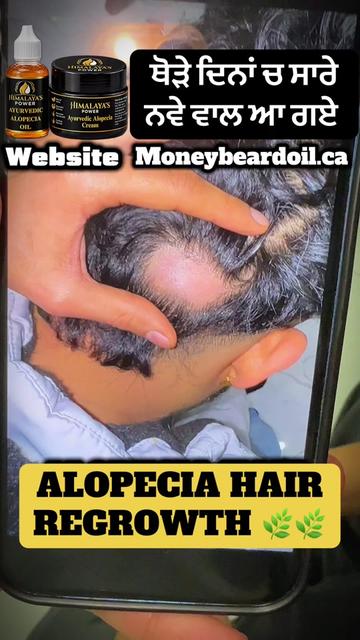 @money_beard_growthoil