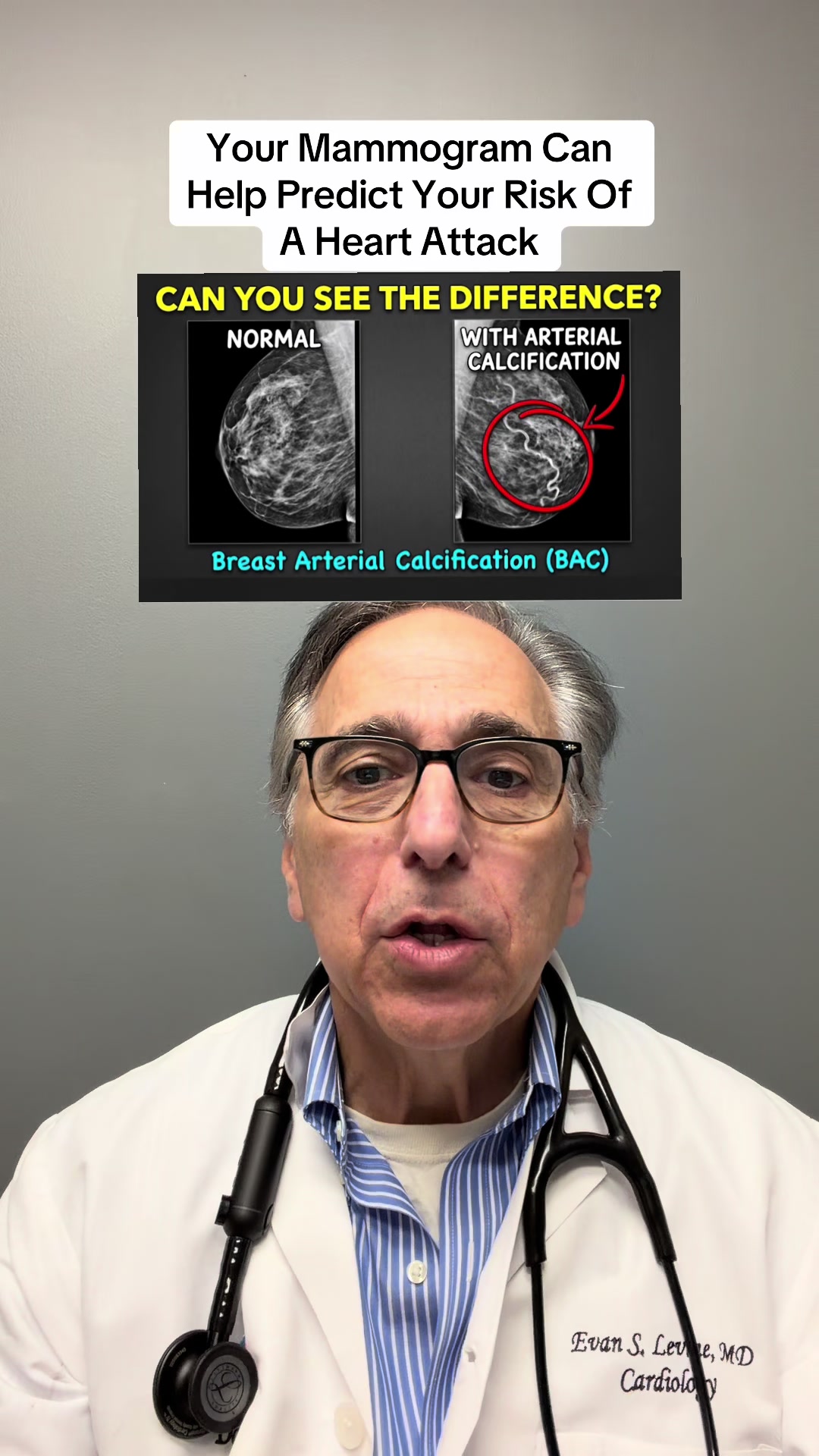@Evan S. Levine, MD FACC