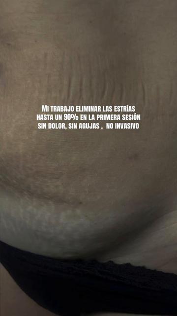 @Tania Estr&iacute;as
