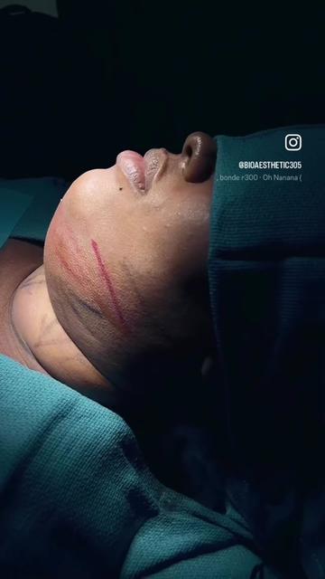 @BioAesthetic305