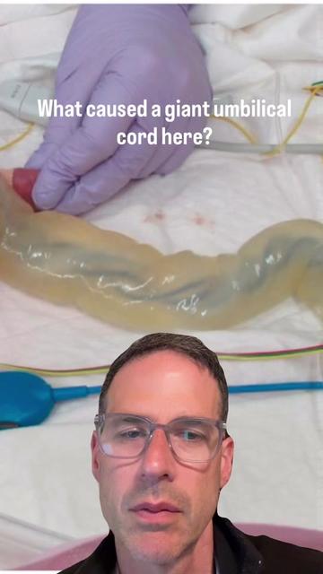 @Dr Michael Narvey 🇨🇦