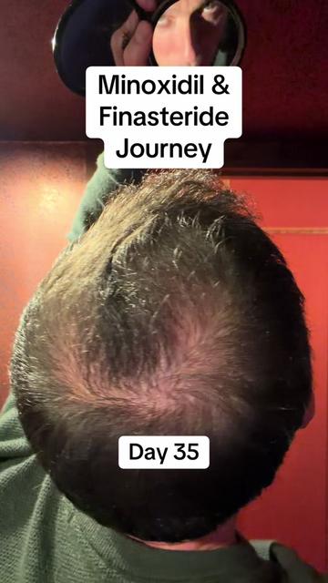 @scalp.hero