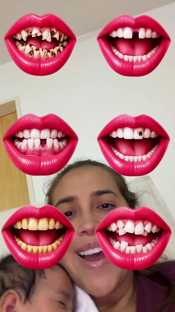 @Edarcapher