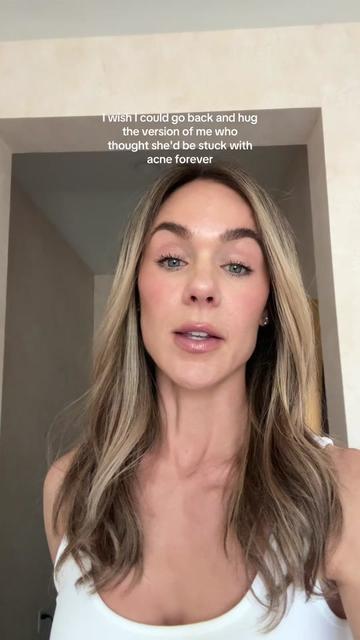 @Celeste | RN acne expert