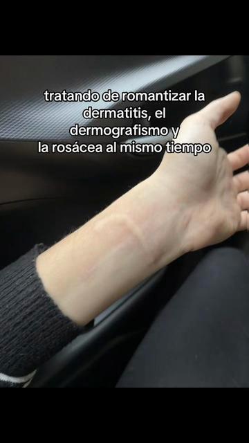 @Candela