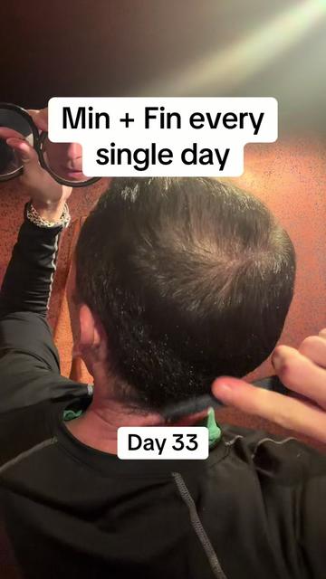 @scalp.hero