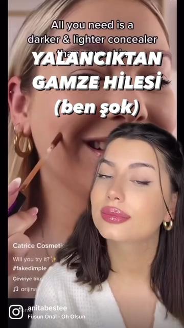 @Anita🫶🏼